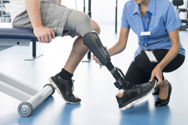 Tips for Taking Care of Your Prosthesis