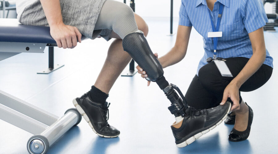 Care of Your Prosthesis
